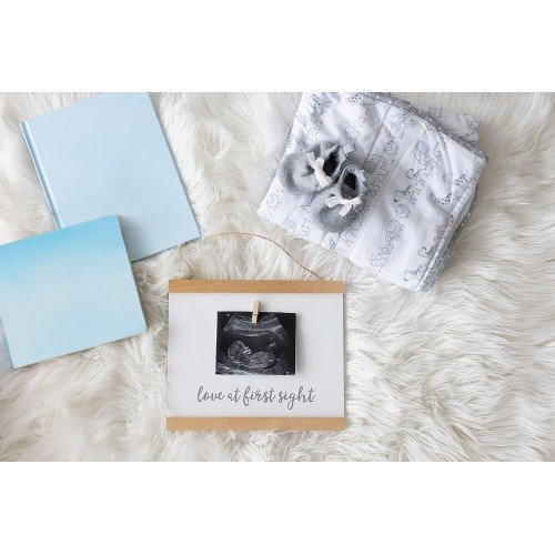 Tablou ecografie Pearhead – imaginea 4